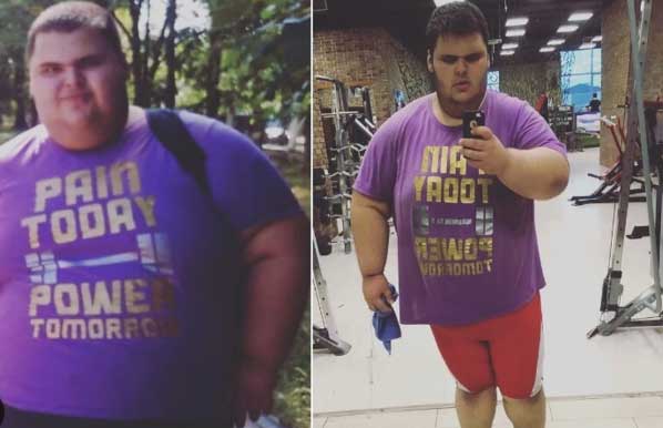 Therapeutic Diet: Diet for Obesity